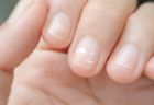 Какви са тези бели петна под ноктите ни и защо се появяват понякога? 
